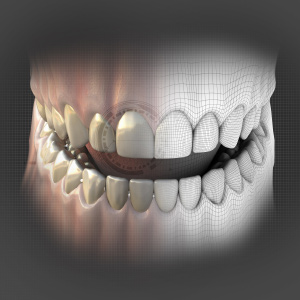 Digital Workflow in Restorative Dentistry eBook Thumbnail