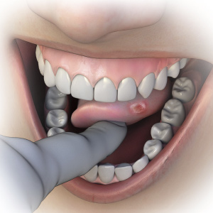 Oral Pathology: Techniques for Detection and Differential Diagnosis eBook Thumbnail